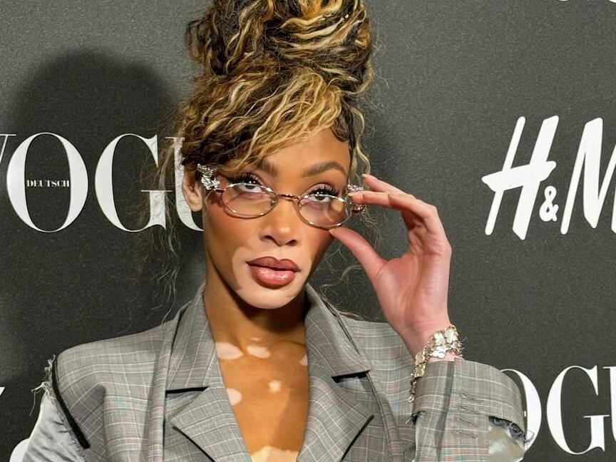 Quem é Winnie Harlow, a bela modelo que está causando impacto nas redes dançando a última música de Shakira?